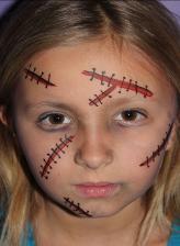 A girl with stitches all over her face.